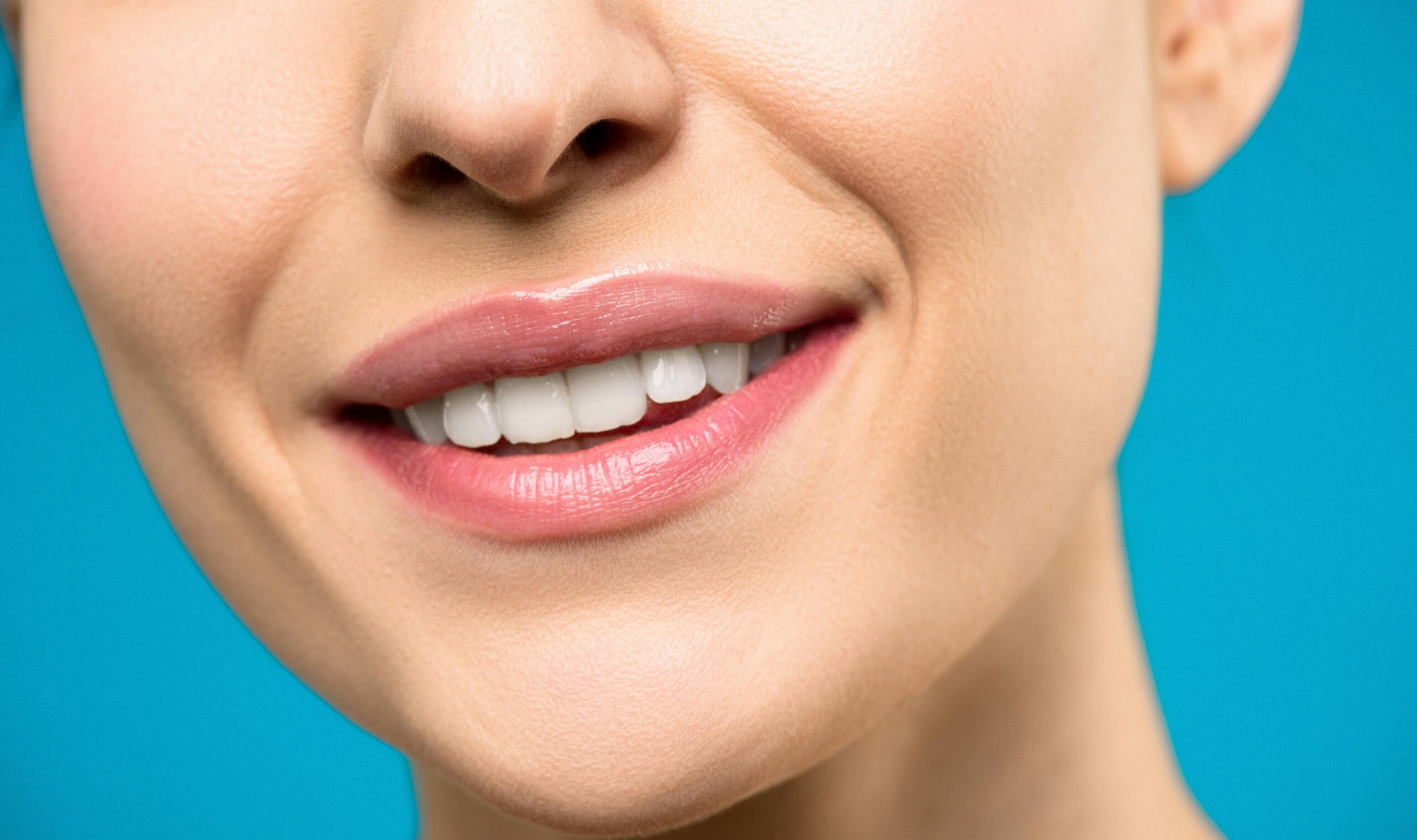 dental veneers Singapore