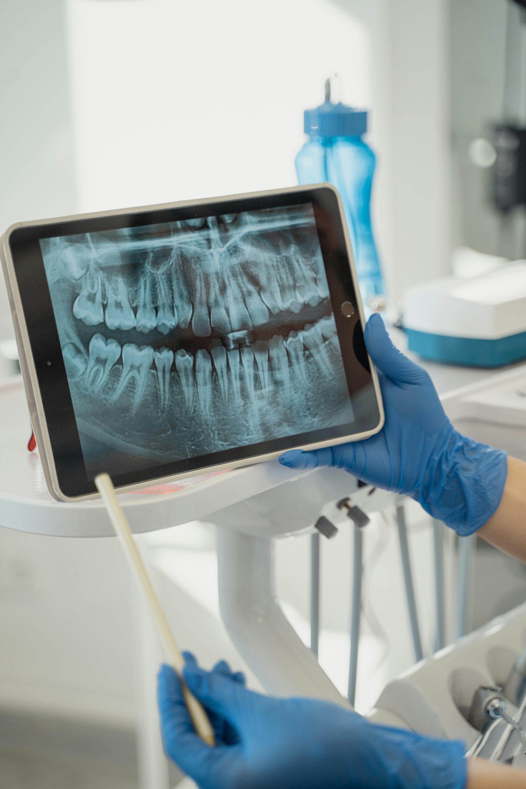 dental x-rays Singapore